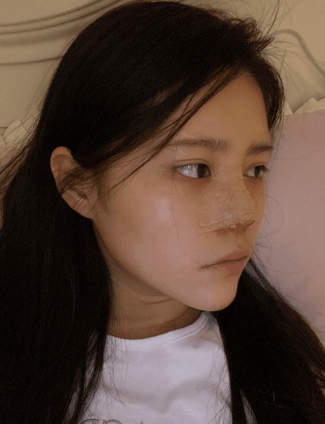 長沙亞韓整形醫(yī)院怎么樣？附隆鼻案例分享+價格表