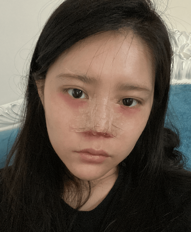 長沙亞韓整形醫(yī)院怎么樣？附隆鼻案例分享+價格表