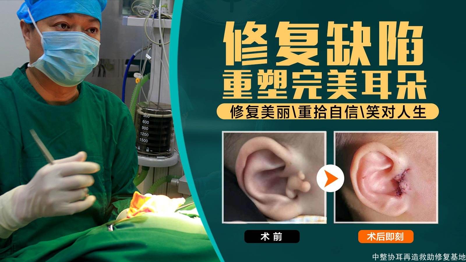 中國(guó)耳再造專家前10強(qiáng),前三安波/余文林/郭樹(shù)忠后悔知道晚了