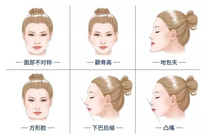 上海九院整形科輪廓整形價格