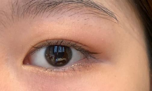 割雙眼皮多少錢?