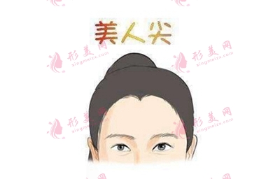 廣州科發(fā)源美人尖種植費用是多少