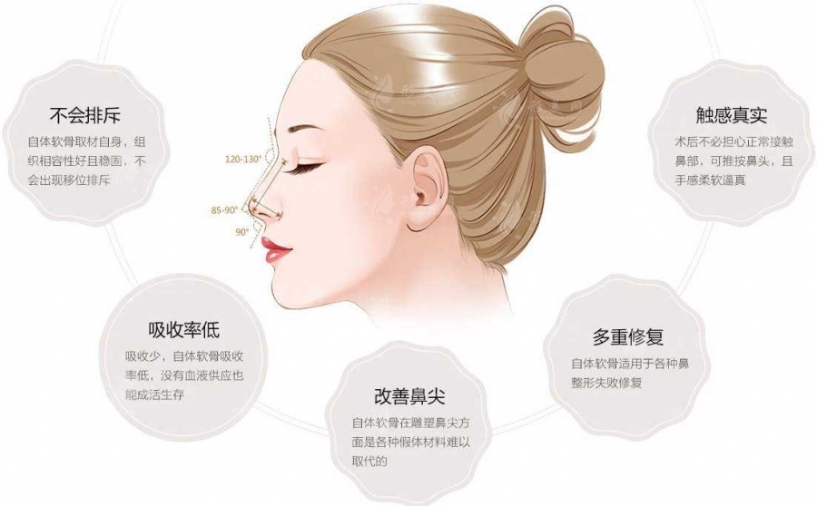 自體軟骨隆鼻手術(shù)