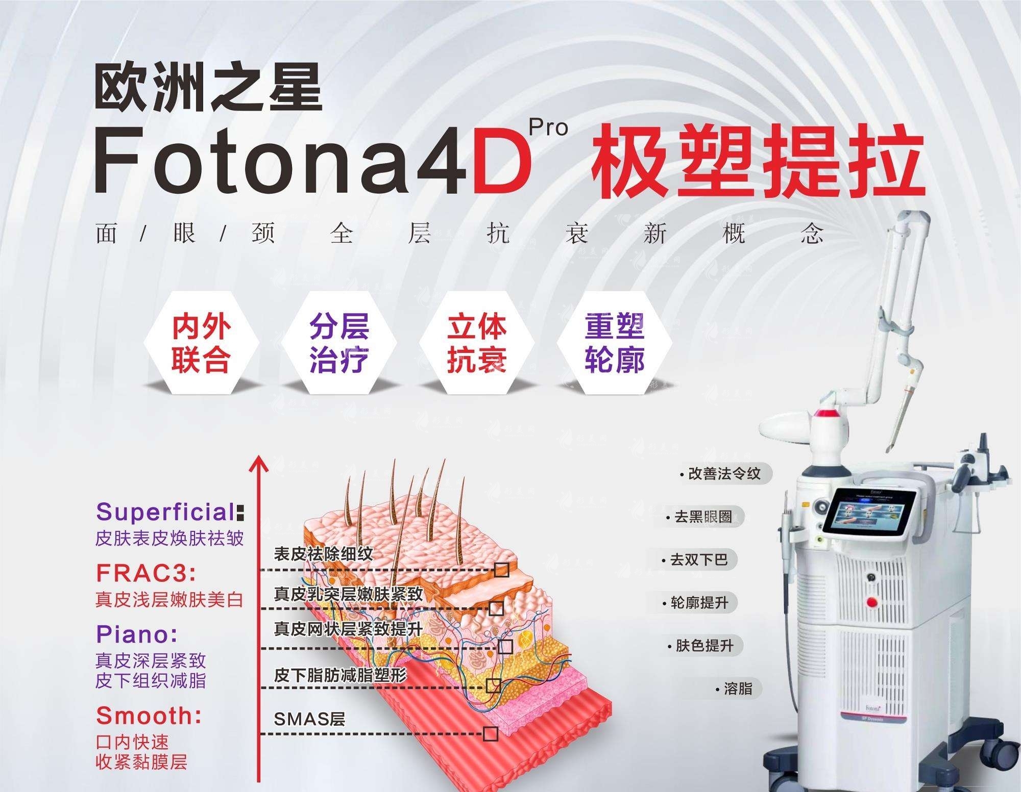 fotona4d做一次維持多久？做完fotona4d需要注意什么？