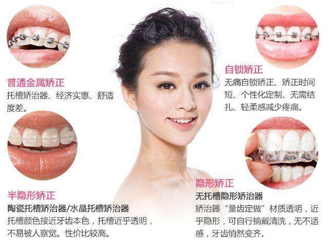 牙齒矯正