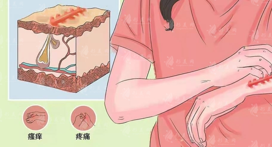 上海九院疤痕整形的案例介紹