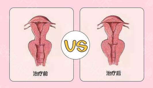 上海時(shí)光整形外科醫(yī)院做私密手術(shù)口碑好