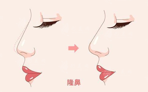 重慶李喆怎么預(yù)約掛號(hào)？