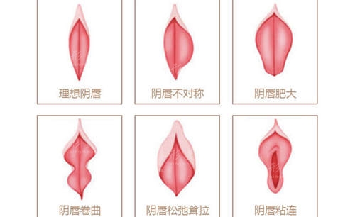 南京私密整形醫(yī)院在哪里?排名名單康美/美貝爾顧客滿意度高 南京私密整形醫(yī)院在哪里?排名名單康美/美貝爾顧客滿意度高