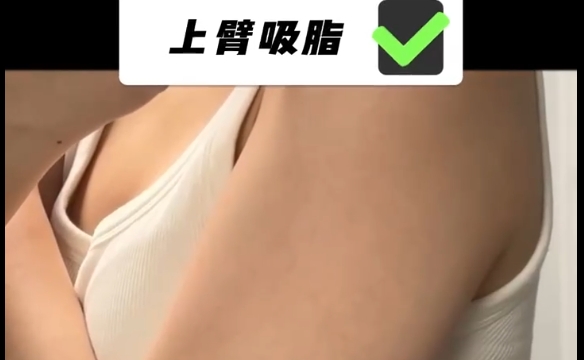 吸脂后上癮的原因是什么？程辰醫(yī)生為你解開(kāi)疑團(tuán)