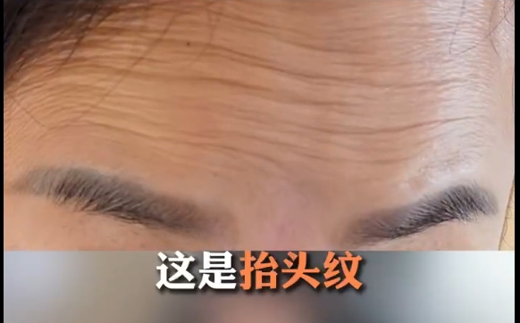 明明都是抬頭紋，為什么改善的方式不一樣？