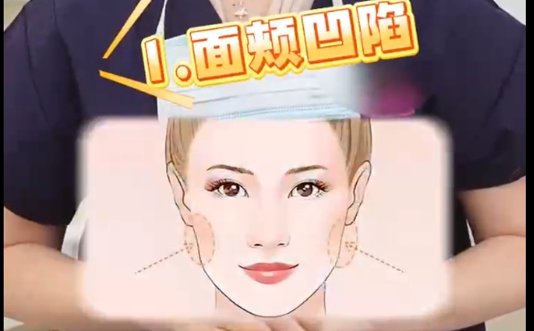 肉毒素再好，這兩種人統(tǒng)統(tǒng)勸退？魏皎醫(yī)生告訴你 