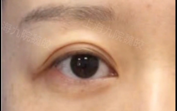 這種眼睛除了做提眉，其他什么也別做！
