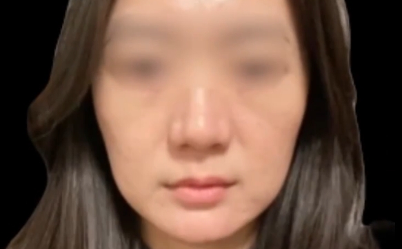 30+年齡女性值得嘗試的3個(gè)醫(yī)美項(xiàng)目，魏皎醫(yī)生詳細(xì)解讀