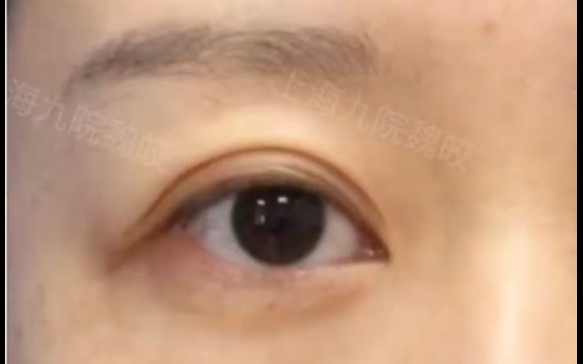 這種眼睛除了提眉，其他的什么都別做！