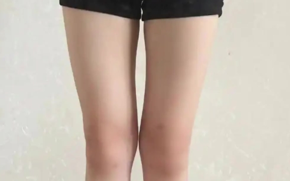 腿圍多少算粗？看完你就不焦慮了