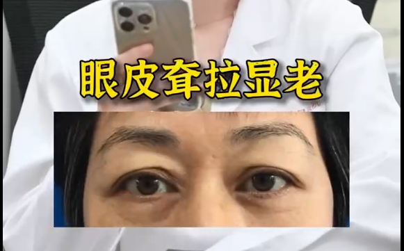 聽整形醫(yī)生一句勸：眼皮松弛別老想著提眉