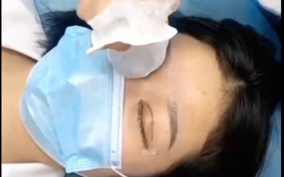 7個雙眼皮恢復期的壞習慣，別再犯了！馮少清醫(yī)生教你正確護理