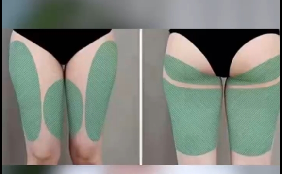 大腿千萬別亂吸，小心裙子沒辦法穿！程辰醫(yī)生告訴你