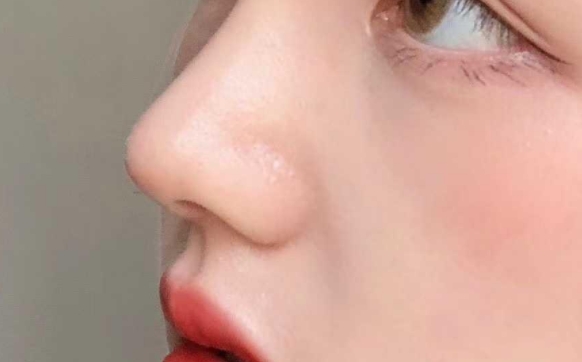隆鼻三大謠言，你被騙了多久？