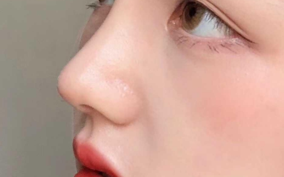 初鼻為什么不做肋軟骨？魏皎醫(yī)生告訴你