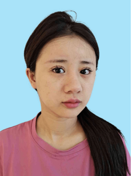 * 主題 重慶星宸醫(yī)院隆鼻怎么樣？真實(shí)隆鼻案例分享及價(jià)格表
