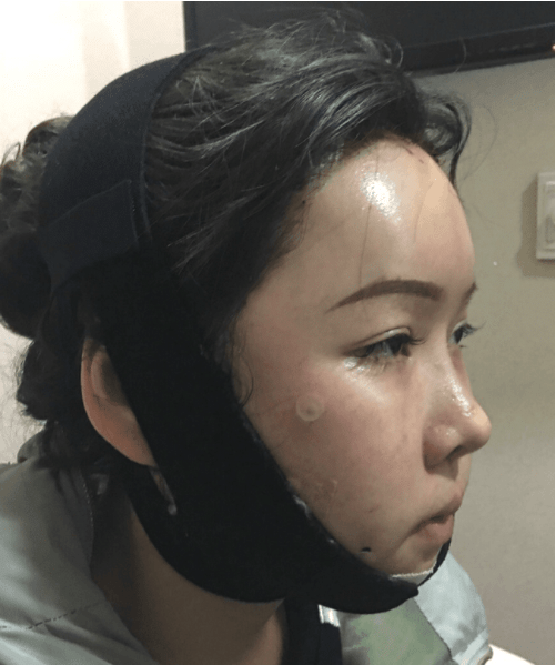 北京八大處磨骨多少錢？2022價(jià)格表曝光+磨骨案例