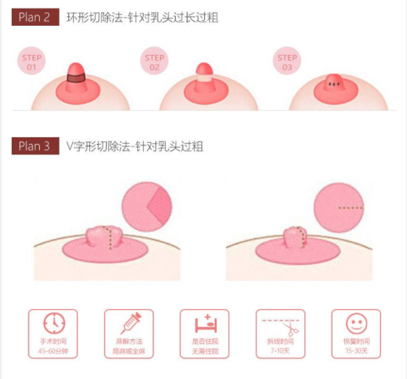 做完乳頭縮小手術(shù)術(shù)后注意事項(xiàng)