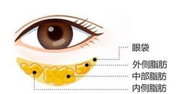 眼袋整形價(jià)格