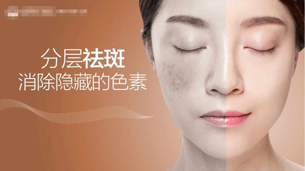 激光祛斑會(huì)留疤嗎