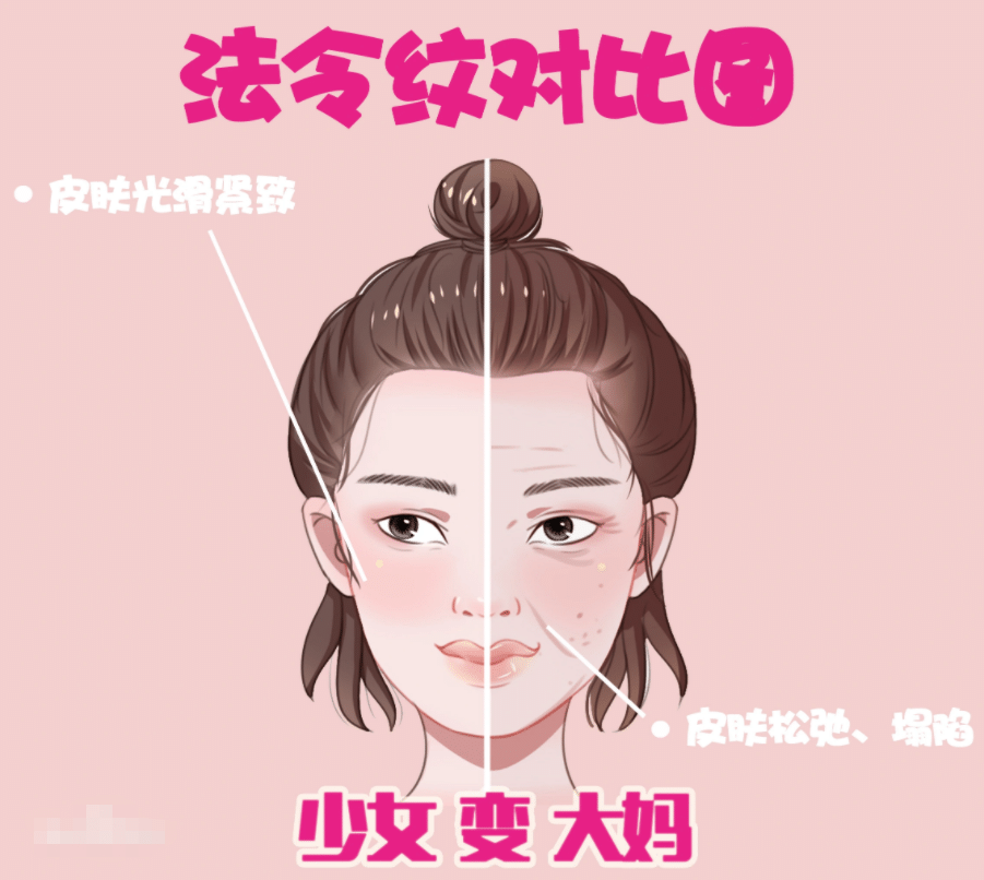 去除法令紋