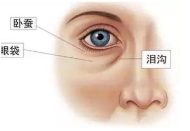 怎樣徹底去除眼袋？詳細講解眼袋形成的原因及如何去除