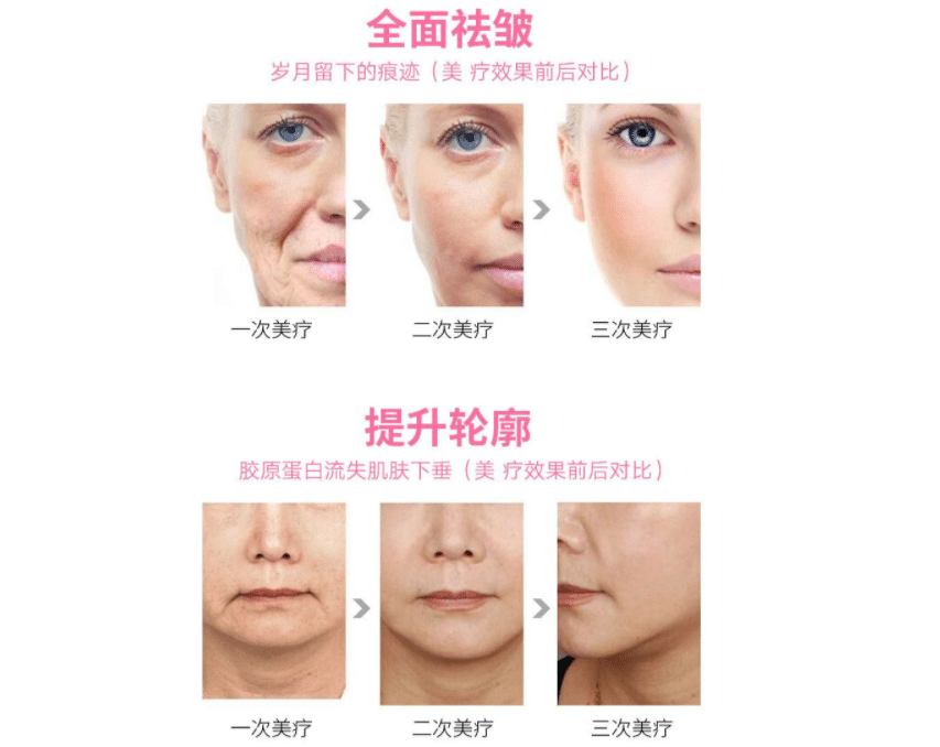 提升抗鄒 提升抗鄒