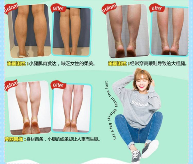 保妥適瘦小腿 保妥適瘦小腿