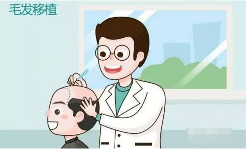 毛發(fā)移植