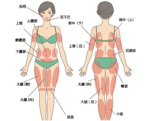 全身吸脂多少錢