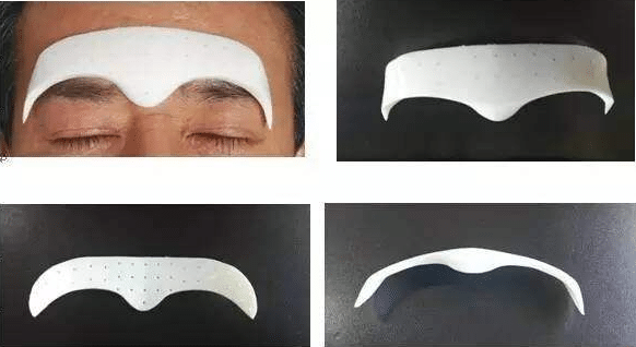 隆眉弓的效果有哪些?眉弓隆高的常用方法有哪些?