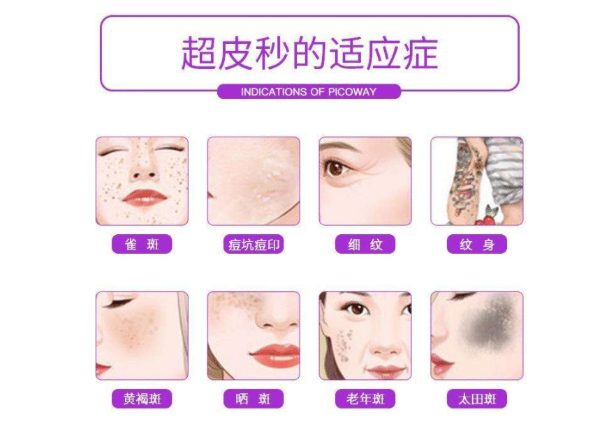 超皮秒的適應癥有哪些