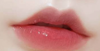 豐唇