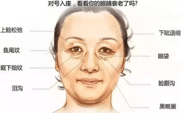 眼部肌膚狀況 眼部肌膚狀況