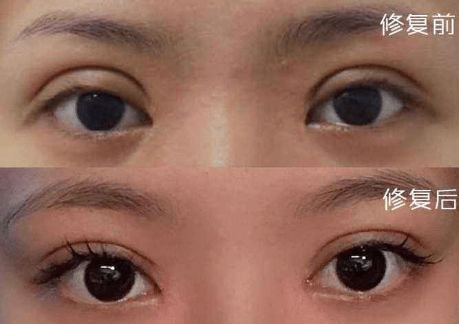 修復(fù)前后對比