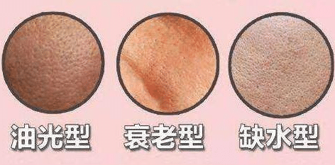 毛孔粗大的類型