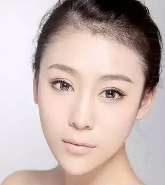瓜子臉