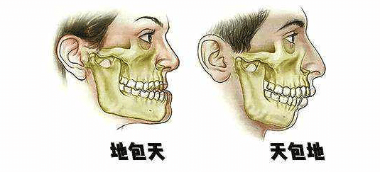 天包地圖片