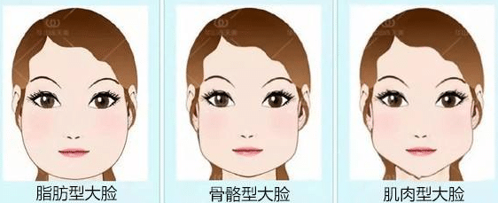 瘦臉的分類