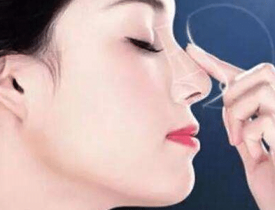 耳軟骨隆鼻