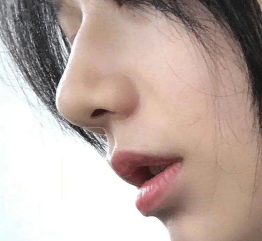 什么是膠原蛋白隆鼻?膠原蛋白可以用于隆鼻嗎?