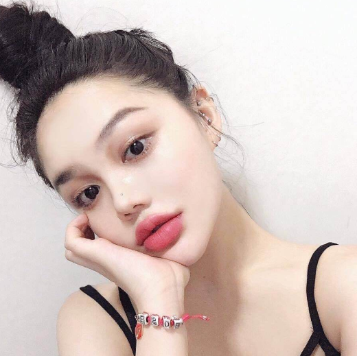 玻尿酸豐唇