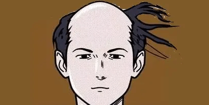 脫發(fā)