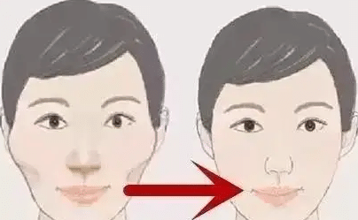 磨顴骨前后對(duì)比